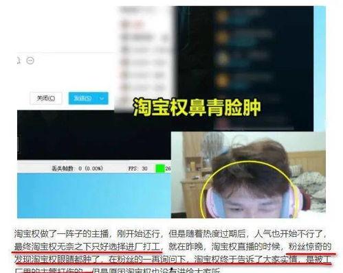 豆瓣的爆料在哪看啊视频,揭秘“在哪看啊”视频观看攻略 第2张 豆瓣的爆料在哪看啊视频,揭秘“在哪看啊”视频观看攻略 第2张